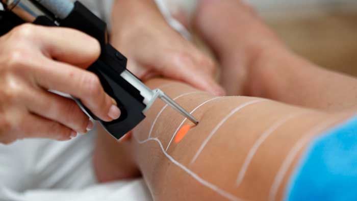 آیا در مورد کاربرد‌های لیزر در علوم پزشکی میدانید؟