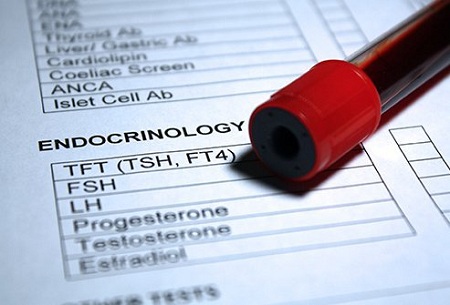 افزایش میزان FSH در آزمایش خون, آزمایش fsh, آزمایش fsh lh