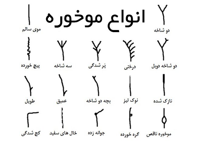 انواع موخوره