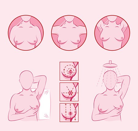 معاینه سینه توسط خود فرد, معاینه سینه زنان برای سرطان