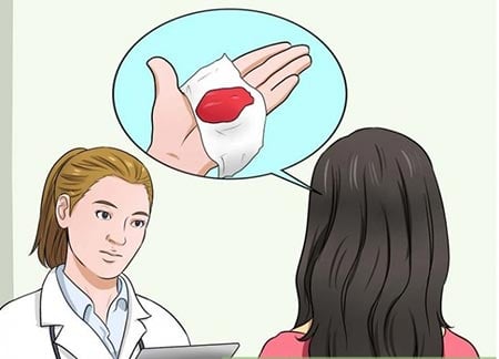 خون سیاه قبل از پریود شدن,علت خون سیاه قبل از پریود شدن,لکه بینی قبل از پریود