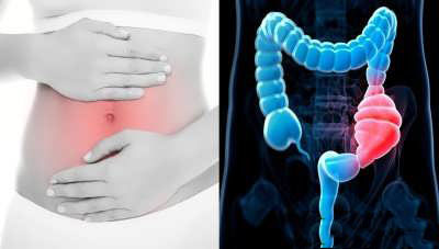 درمان یبوست با خواص دارویی برگ انجیر