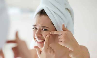 درمان آکنه با خواص عرق بوقناق