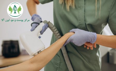 فواید از بین بردن موهای زائد,لیزر موهای زائد