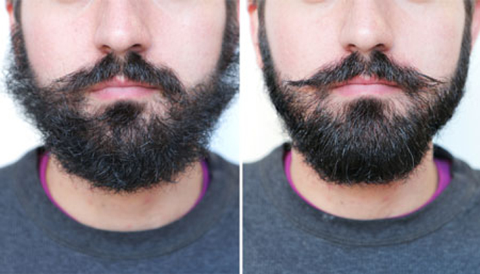 قبل و بعد استفاده از روغن تقویت ریش