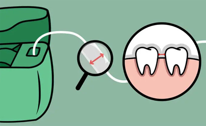 ضخامت نخ دندان