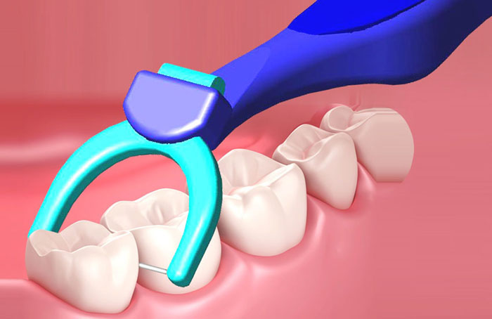 نخ دندان برقی یا الکتریکی