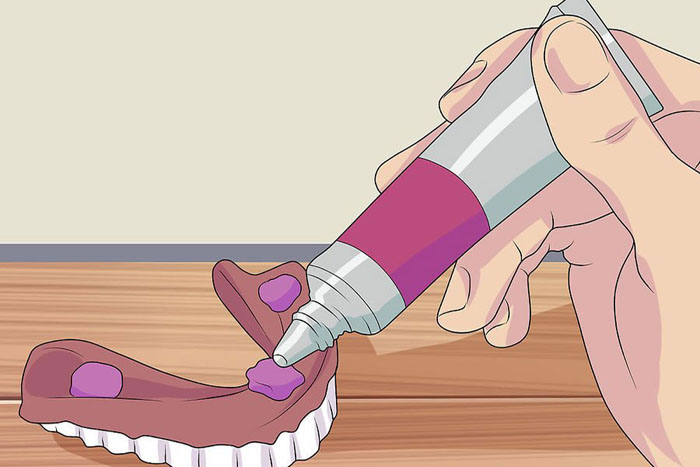 چسب دندان مصنوعی